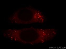 FLNB Rabbit anti-Human, Mouse, Rat, Polyclonal, Proteintech 150 &mu;L;