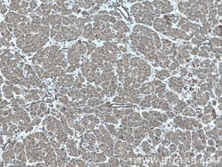 FLNB Rabbit anti-Human, Mouse, Rat, Polyclonal, Proteintech 150 &mu;L;