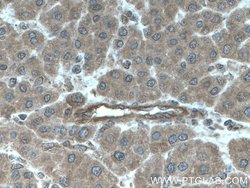 FLNB Rabbit anti-Human, Mouse, Rat, Polyclonal, Proteintech 150 &mu;L;