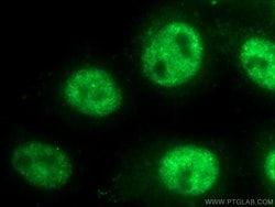 TOP1 Rabbit anti-Human, Mouse, Rat, Polyclonal, Proteintech:Antibodies:Primary