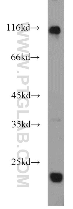 ESPN Rabbit anti-Human, Mouse, Rat, Polyclonal, Proteintech 150 μL;