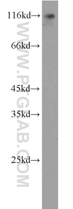 ESPN Rabbit anti-Human, Mouse, Rat, Polyclonal, Proteintech 150 μL;