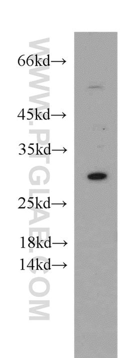 ESPN Rabbit anti-Human, Mouse, Rat, Polyclonal, Proteintech 150 μL;