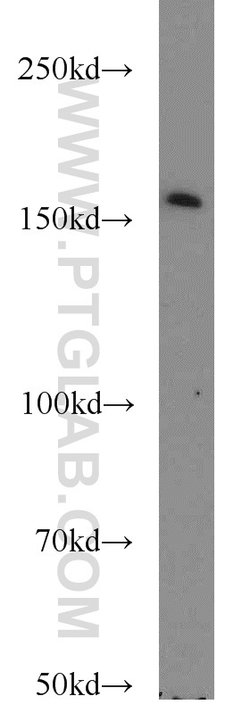 SYNM Rabbit anti-Human, Polyclonal, Proteintech 150 &mu;L; Unconjugated:Antibodies,