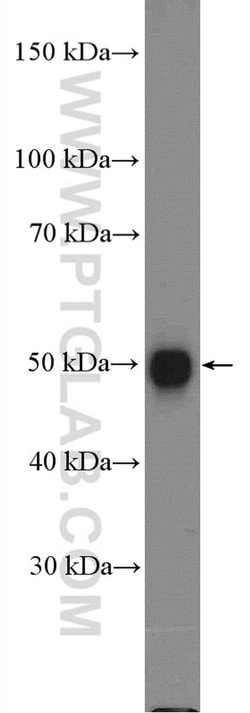 SOX1 Rabbit anti-Human, Polyclonal, Proteintech:Antibodies:Primary Antibodies