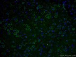 CHAT Rabbit anti-Human, Mouse, Rat, Polyclonal, Proteintech:Antibodies:Primary