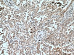CHAT Rabbit anti-Human, Mouse, Rat, Polyclonal, Proteintech:Antibodies:Primary