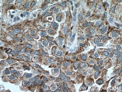 CHAT Rabbit anti-Human, Mouse, Rat, Polyclonal, Proteintech:Antibodies:Primary