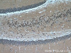 CHAT Rabbit anti-Human, Mouse, Rat, Polyclonal, Proteintech:Antibodies:Primary