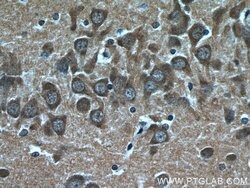 CHAT Rabbit anti-Human, Mouse, Rat, Polyclonal, Proteintech:Antibodies:Primary