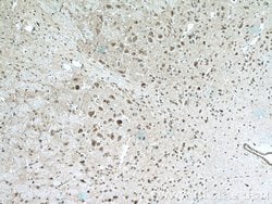 CHAT Rabbit anti-Human, Mouse, Rat, Polyclonal, Proteintech:Antibodies:Primary