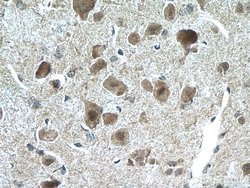 CHAT Rabbit anti-Human, Mouse, Rat, Polyclonal, Proteintech:Antibodies:Primary