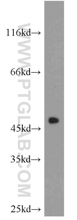 CHAT Rabbit anti-Human, Mouse, Rat, Polyclonal, Proteintech:Antibodies:Primary