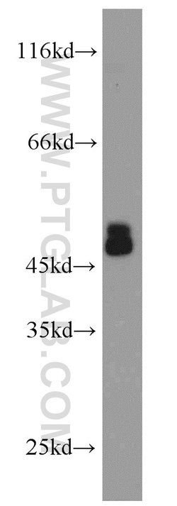 CHAT Rabbit anti-Human, Mouse, Rat, Polyclonal, Proteintech:Antibodies:Primary