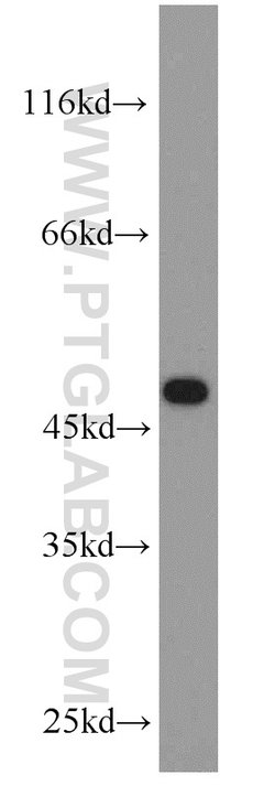 CHAT Rabbit anti-Human, Mouse, Rat, Polyclonal, Proteintech:Antibodies:Primary