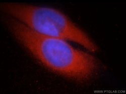 CHAT Rabbit anti-Human, Mouse, Rat, Polyclonal, Proteintech:Antibodies:Primary
