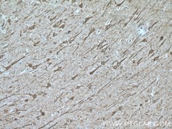 CHAT Rabbit anti-Human, Mouse, Rat, Polyclonal, Proteintech:Antibodies:Primary