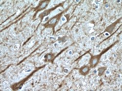 CHAT Rabbit anti-Human, Mouse, Rat, Polyclonal, Proteintech:Antibodies:Primary