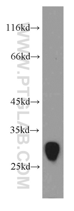 TMEM41A Rabbit anti-Human, Mouse, Rat, Polyclonal, Proteintech 20 &mu;L;