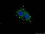 Thumbnail_GSDMD Rabbit anti-Human, Polyclonal, Proteintech 150 &mu;L; Unconjugated:Anticuerpos