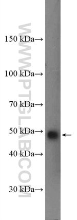 Thumbnail_GSDMD Rabbit anti-Human, Polyclonal, Proteintech 150 &mu;L; Unconjugated:Anticuerpos