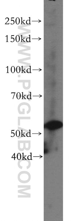 VIPAS39 Rabbit anti-Human, Mouse, Rat, Polyclonal, Proteintech 150 &mu;L;