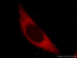 VIPAS39 Rabbit anti-Human, Mouse, Rat, Polyclonal, Proteintech 150 &mu;L;