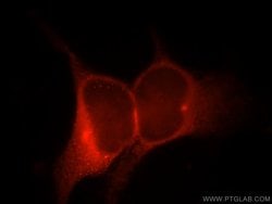 VIPAS39 Rabbit anti-Human, Mouse, Rat, Polyclonal, Proteintech 150 &mu;L;