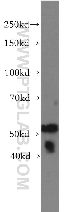 VIPAS39 Rabbit anti-Human, Mouse, Rat, Polyclonal, Proteintech 150 &mu;L;