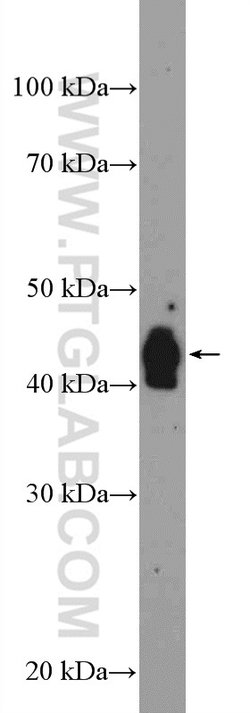 VIPAS39 Rabbit anti-Human, Mouse, Rat, Polyclonal, Proteintech 150 &mu;L;