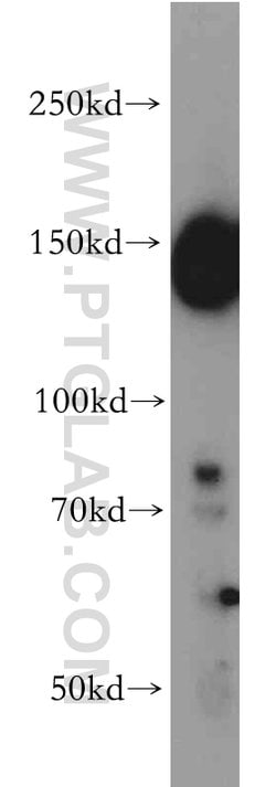 FANCI Rabbit anti-Human, Polyclonal, Proteintech:Antibodies:Primary Antibodies