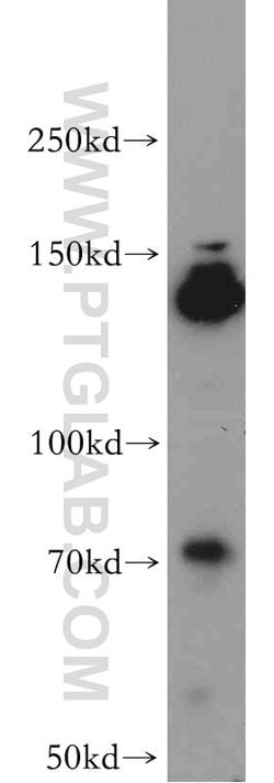 FANCI Rabbit anti-Human, Polyclonal, Proteintech:Antibodies:Primary Antibodies