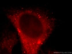 FANCI Rabbit anti-Human, Polyclonal, Proteintech:Antibodies:Primary Antibodies