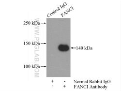 FANCI Rabbit anti-Human, Polyclonal, Proteintech:Antibodies:Primary Antibodies