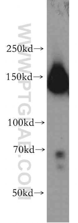 FANCI Rabbit anti-Human, Polyclonal, Proteintech:Antibodies:Primary Antibodies