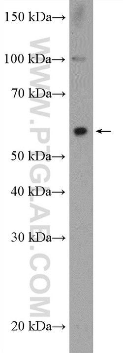 ZNF397 Rabbit anti-Human, Mouse, Polyclonal, Proteintech 150 &mu;L; Unconjugated:Antibodies,