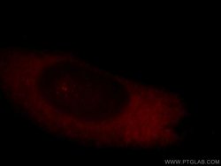 CLASP1 Rabbit anti-Human, Mouse, Rat, Polyclonal, Proteintech 150 &mu;L;