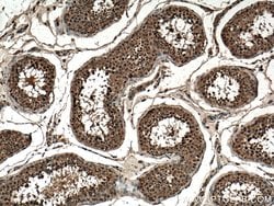 CLASP1 Rabbit anti-Human, Mouse, Rat, Polyclonal, Proteintech 150 &mu;L;