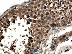 CLASP1 Rabbit anti-Human, Mouse, Rat, Polyclonal, Proteintech 150 &mu;L;
