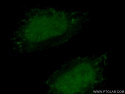 HTATSF1 Rabbit anti-Human, Mouse, Rat, Polyclonal, Proteintech 150 &mu;L;