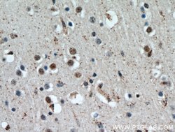 HTATSF1 Rabbit anti-Human, Mouse, Rat, Polyclonal, Proteintech 150 &mu;L;