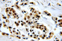 HTATSF1 Rabbit anti-Human, Mouse, Rat, Polyclonal, Proteintech 150 &mu;L;
