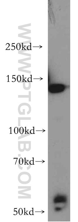 HTATSF1 Rabbit anti-Human, Mouse, Rat, Polyclonal, Proteintech 150 &mu;L;