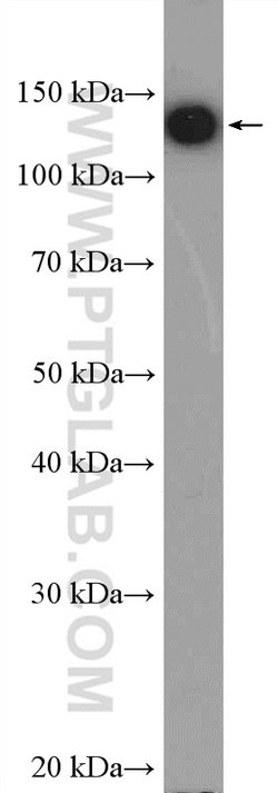 HTATSF1 Rabbit anti-Human, Mouse, Rat, Polyclonal, Proteintech 150 &mu;L;