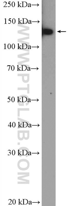 HTATSF1 Rabbit anti-Human, Mouse, Rat, Polyclonal, Proteintech 150 &mu;L;