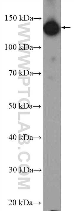 HTATSF1 Rabbit anti-Human, Mouse, Rat, Polyclonal, Proteintech 150 &mu;L;