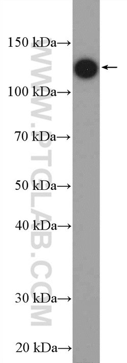HTATSF1 Rabbit anti-Human, Mouse, Rat, Polyclonal, Proteintech 150 &mu;L;