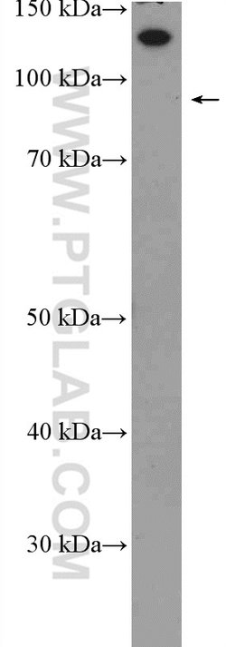 HTATSF1 Rabbit anti-Human, Mouse, Rat, Polyclonal, Proteintech 150 &mu;L;