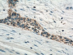 MT2A Rabbit anti-Human, Polyclonal, Proteintech:Antibodies:Primary Antibodies