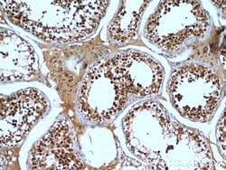 KDM1 Rabbit anti-Human, Mouse, Polyclonal, Proteintech 150 &mu;L; Unconjugated:Antibodies,